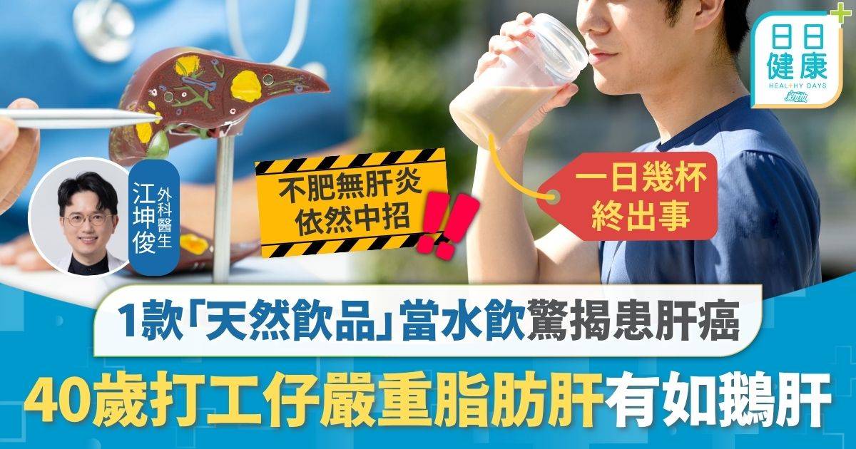 肝癌｜1款「天然飲品」當水飲 40歲打工仔驚揭患肝癌 嚴重脂肪肝 醫生：有如鵝肝