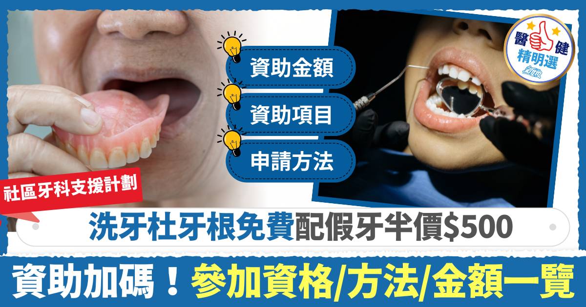 社區牙科支援計劃｜明年資助加碼 洗牙杜牙根免費配假牙半價$500 參加資格/方法/金額一覽
