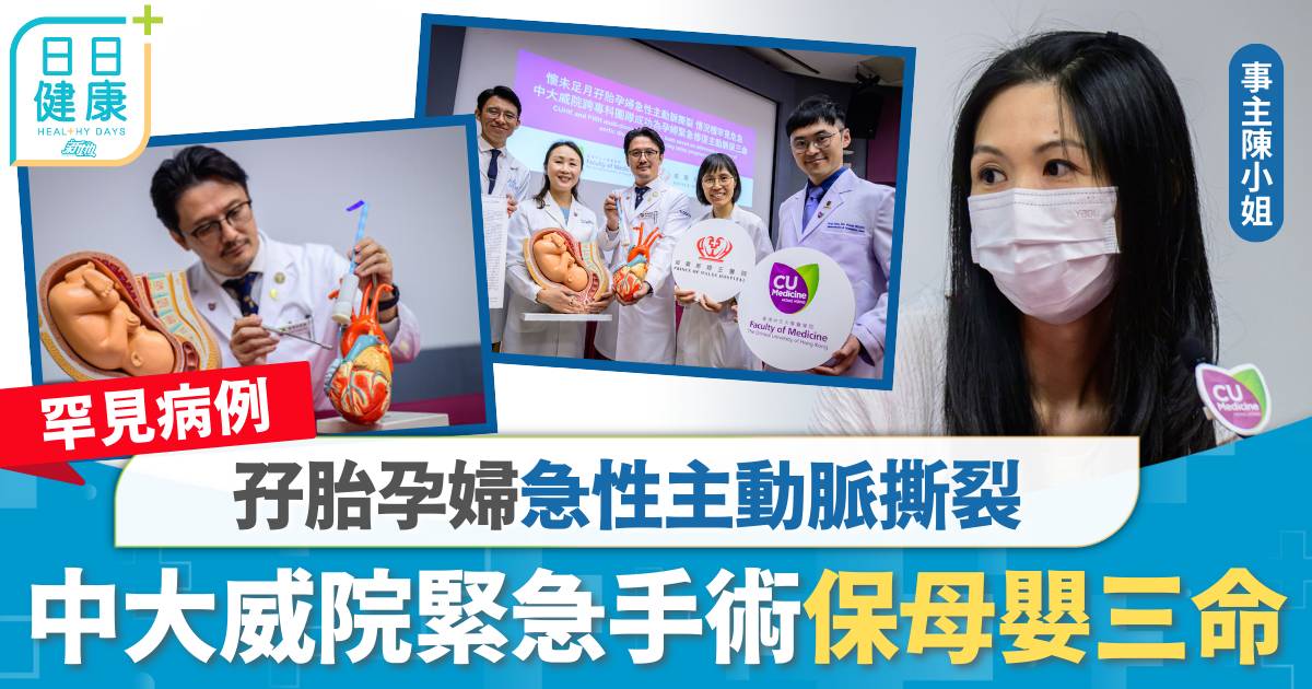 罕見病例｜孖胎孕婦急性主動脈撕裂 中大威院緊急手術保母嬰三命
