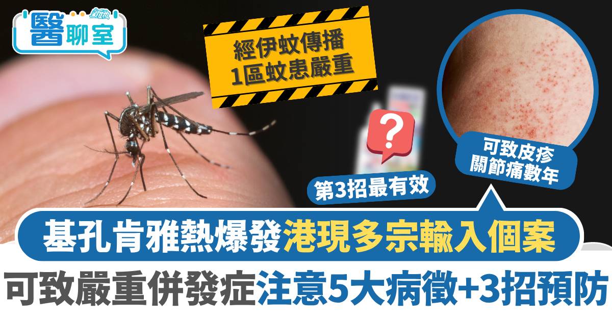 基孔肯雅熱爆發港現多宗輸入個案 港人無抗體可致嚴重併發症 注意5大病徵+3招預防