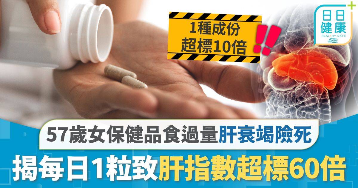 保健風險｜1款天然保健品食過量 57歲女肝衰竭入院險死 揭每日1粒致肝指數超標60倍