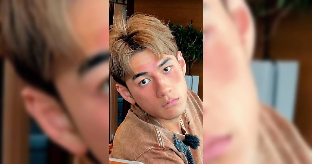 27歲魏浚笙健康亮紅燈！自爆蕁麻疹惡化「唞唔到氣」｜靠奇招抗病魔？