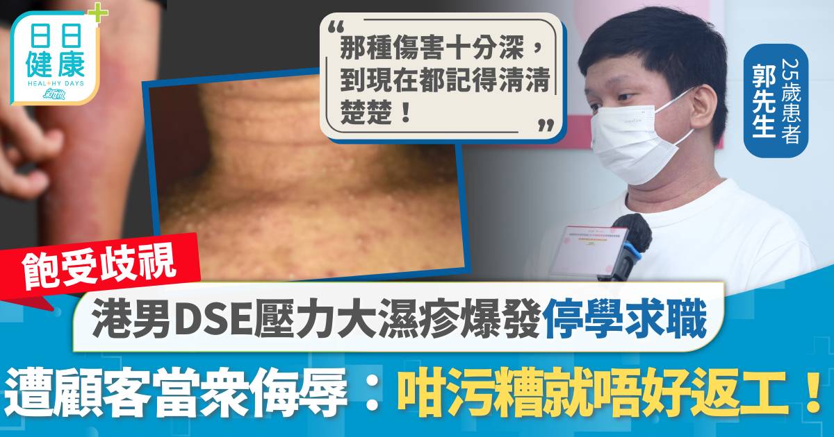 飽受歧視｜DSE壓力大濕疹爆發停學求職 港男遭顧客當眾侮辱：咁污糟就唔好返工！