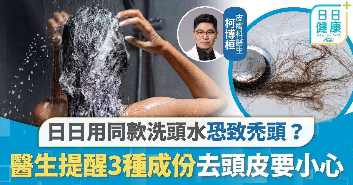 頭皮護理｜日日用同款洗頭水恐致禿頭？ 皮膚科醫生證真有其事 注意3種成份去頭皮要小心