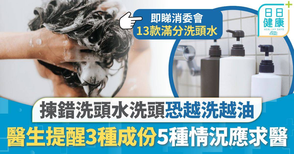 頭皮健康｜日日洗頭或越洗越油 揀錯洗頭水或有反效果 醫生提醒3種成份5種情況應求醫