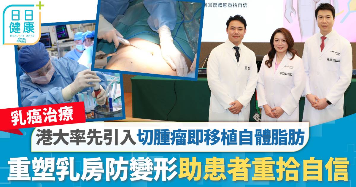 乳癌治療｜港大率先引入切腫瘤即移植自體脂肪 重塑乳房防變形助患者重拾自信