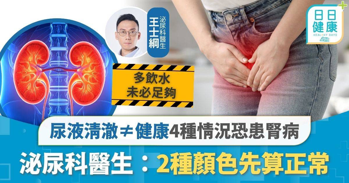 腎病｜尿液清澈明≠健康 4種情況恐患腎病 泌尿科醫生：2種顏色先算正常
