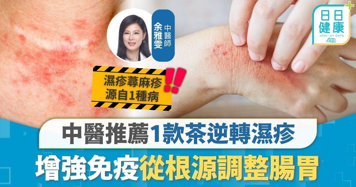 皮膚毛病｜皮膚問題多與飲食有關 中醫推薦1款茶逆轉濕疹 增強免疫從根源調整腸胃