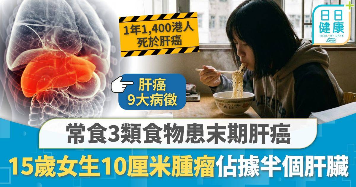 肝癌｜15歲少女患末期肝癌 揭日食3種垃圾食物惹禍 生10厘米腫瘤佔據半個肝臟