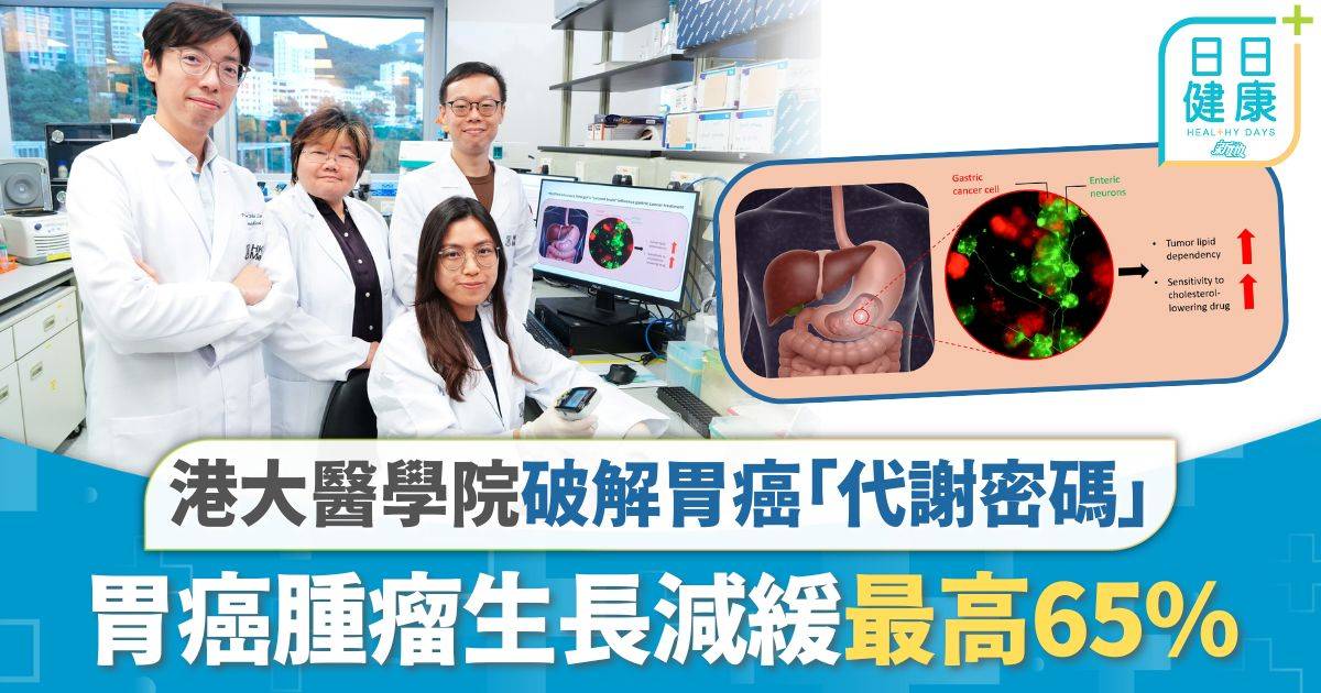 港大醫學院破解胃癌「代謝密碼」 胃癌腫瘤生長減緩最高65%殺癌細胞效率增6倍