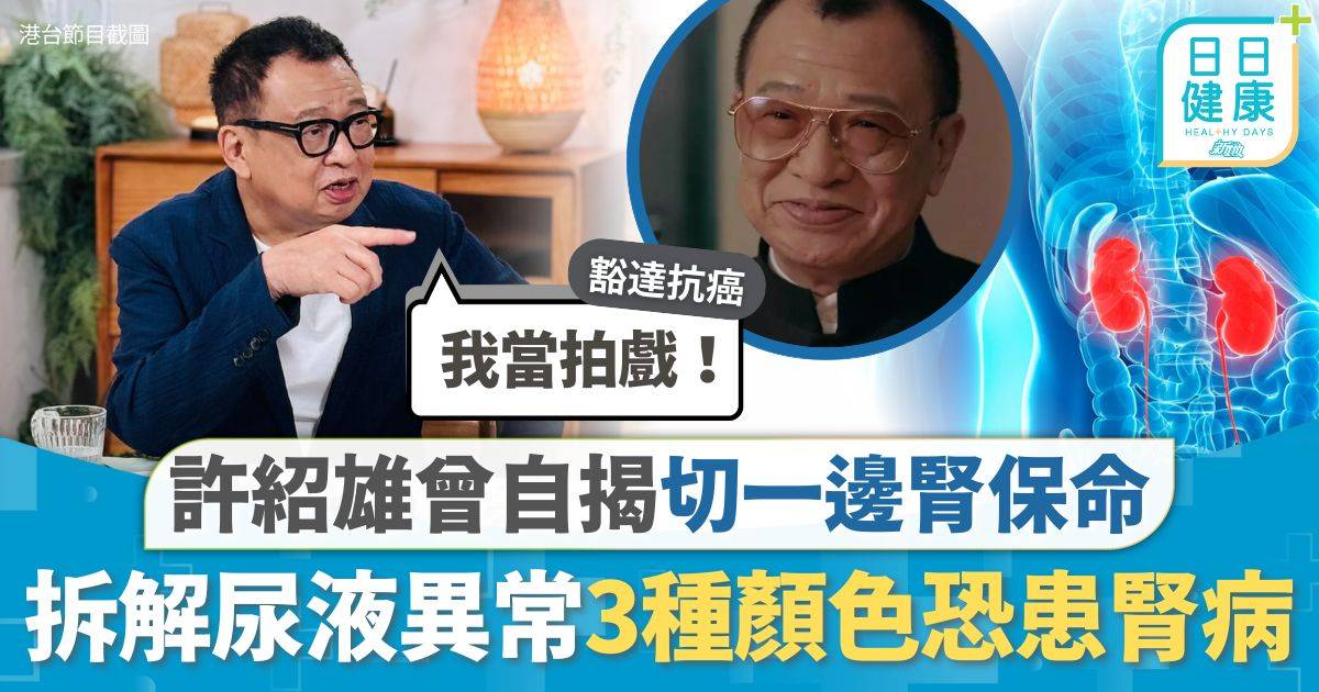 許紹雄腎癌｜小便變深色揭患腎癌 許紹雄曾自揭切一邊腎保命 拆解尿液異常3種顏色恐患腎病