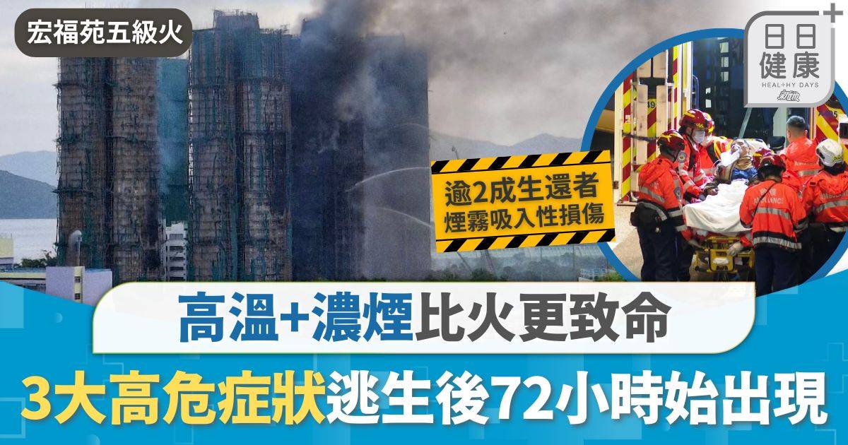 火災求生｜高溫+濃煙比火更致命 醫生揭3大高危症狀 恐逃生後72小時才出現