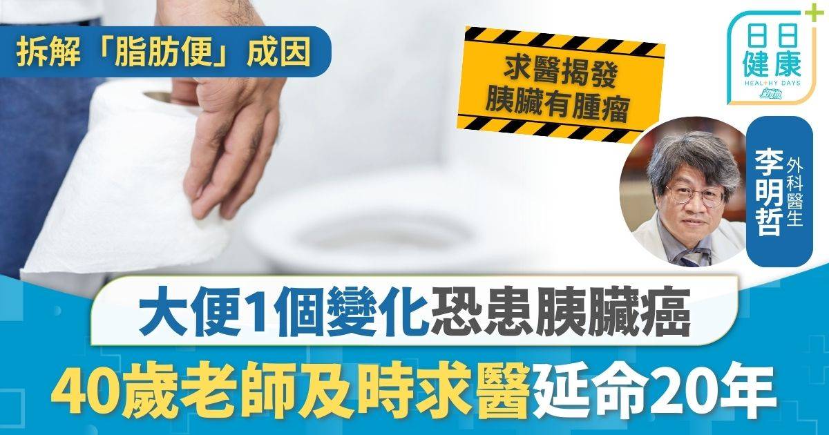 胰臟癌｜大便1個變化恐患胰臟癌 40歲老師及時發現成功康復 醫生提4大癌王徵兆助保命