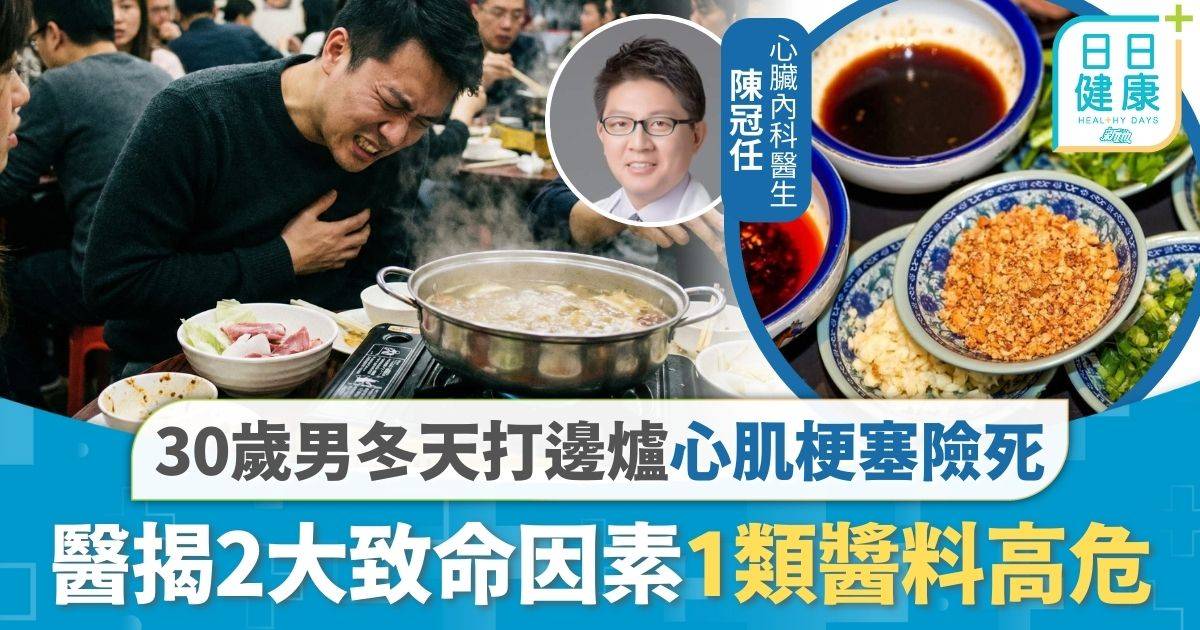 心肌梗塞｜30歲男冬天打邊爐心肌梗塞險死 醫揭2大致命因素1類醬料高危