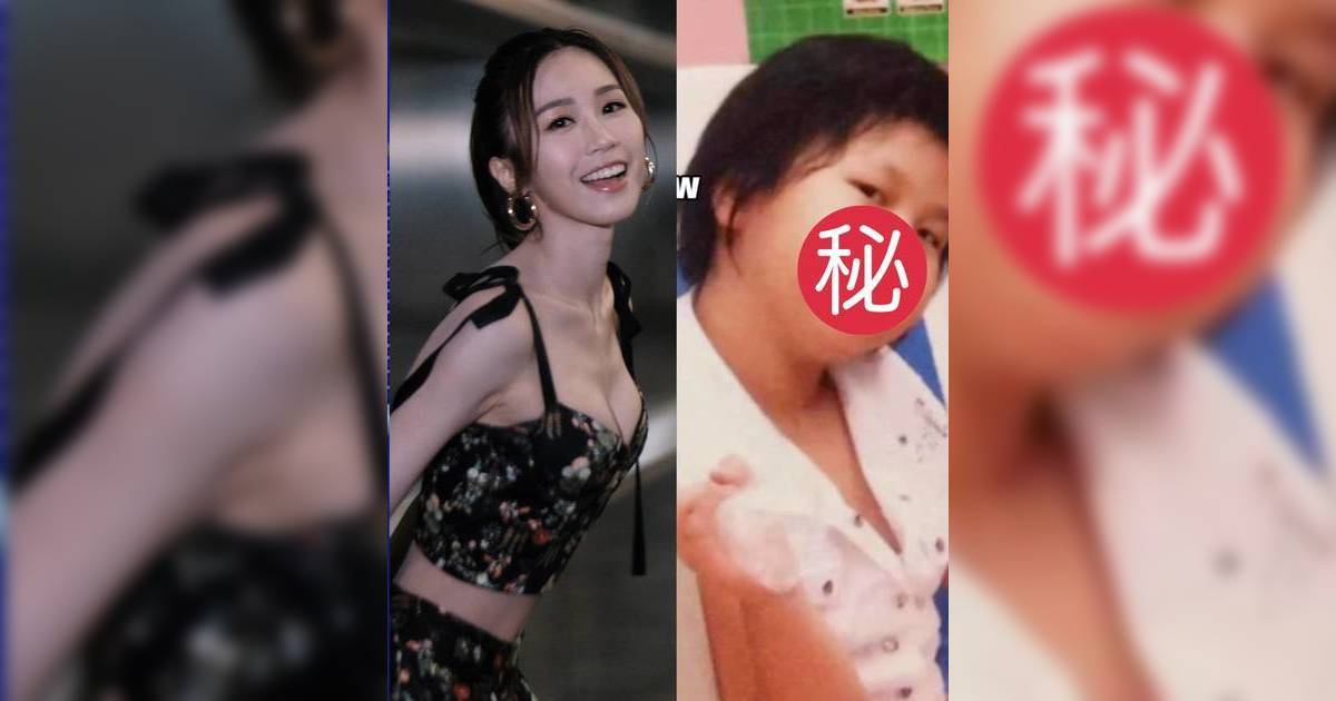 何沛珈自爆70公斤黑歷史！童年肥妹照瘋傳 包包面肉感身形認不出