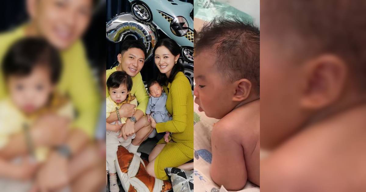 袁偉豪細仔全身瘀青嚇窒網民 腋下腰側臀部瘀黑明顯真相曝光