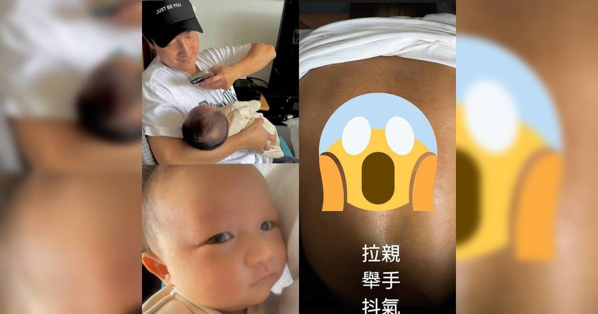 37歲方力申為女兒出事 背脊通紅痛到抖氣都痛被逼缺賽