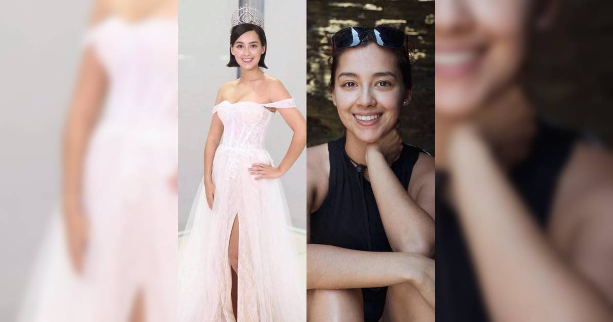 港姐雙料冠軍謝嘉怡首披露患病需終身食藥 偏頭痛脫髮真相曝光