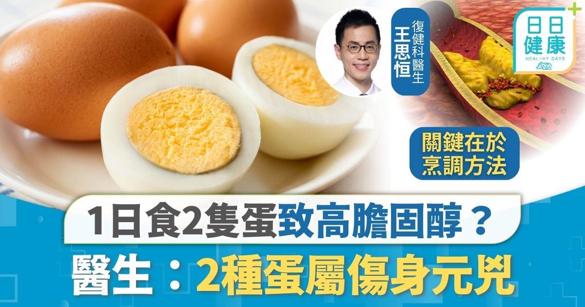 膽固醇｜1日食2隻蛋致高膽固醇？ 醫生：2種種蛋屬傷身元兇 早餐食蛋反有助控血糖