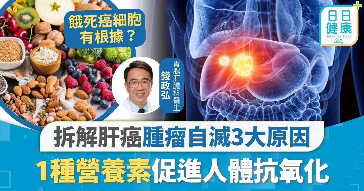 癌症預防｜肝癌可不藥而癒？ 拆解腫瘤自滅3大原因 1種營養素促進人體抗氧化