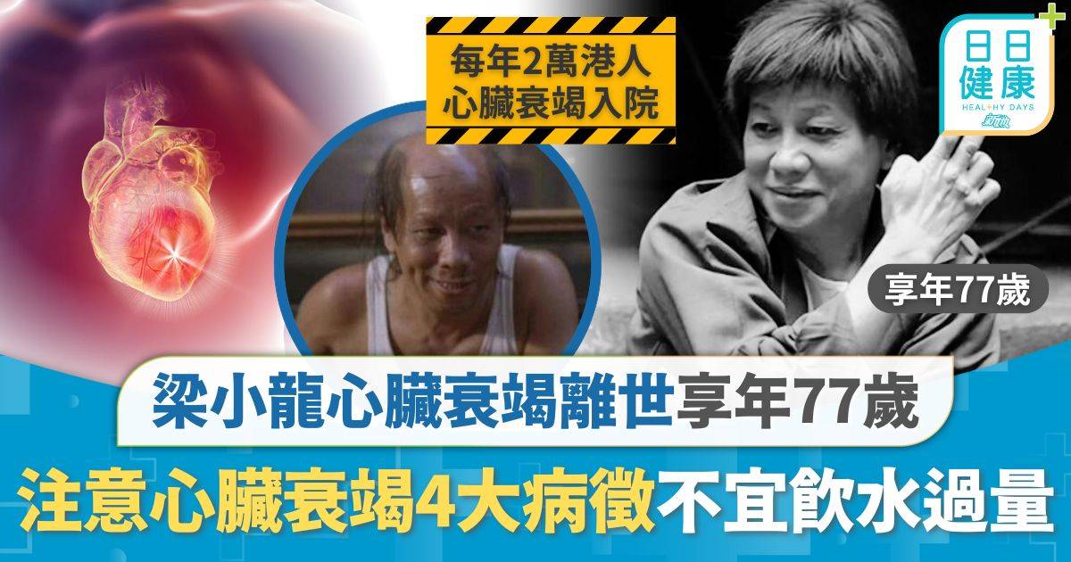 梁小龍逝世｜梁小龍心臟衰竭離世享年77歲 注意心臟衰竭4大病徵 初期症狀不明顯不宜飲水過量