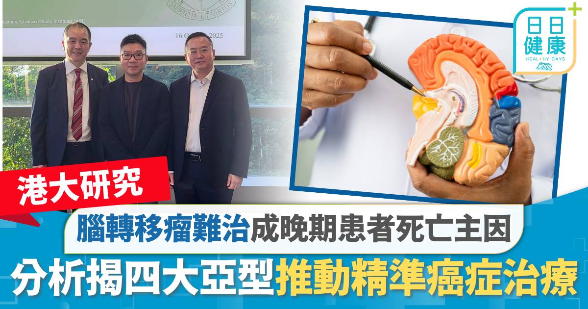港大研究｜腦轉移瘤難治成晚期患者死亡主因 分析揭四大亞型推動精準癌症治療