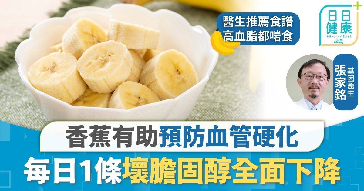 飲食營養｜香蕉有助預防血管硬化 每日1條壞膽固醇全面下降 醫生：一款香蕉可穩定血糖
