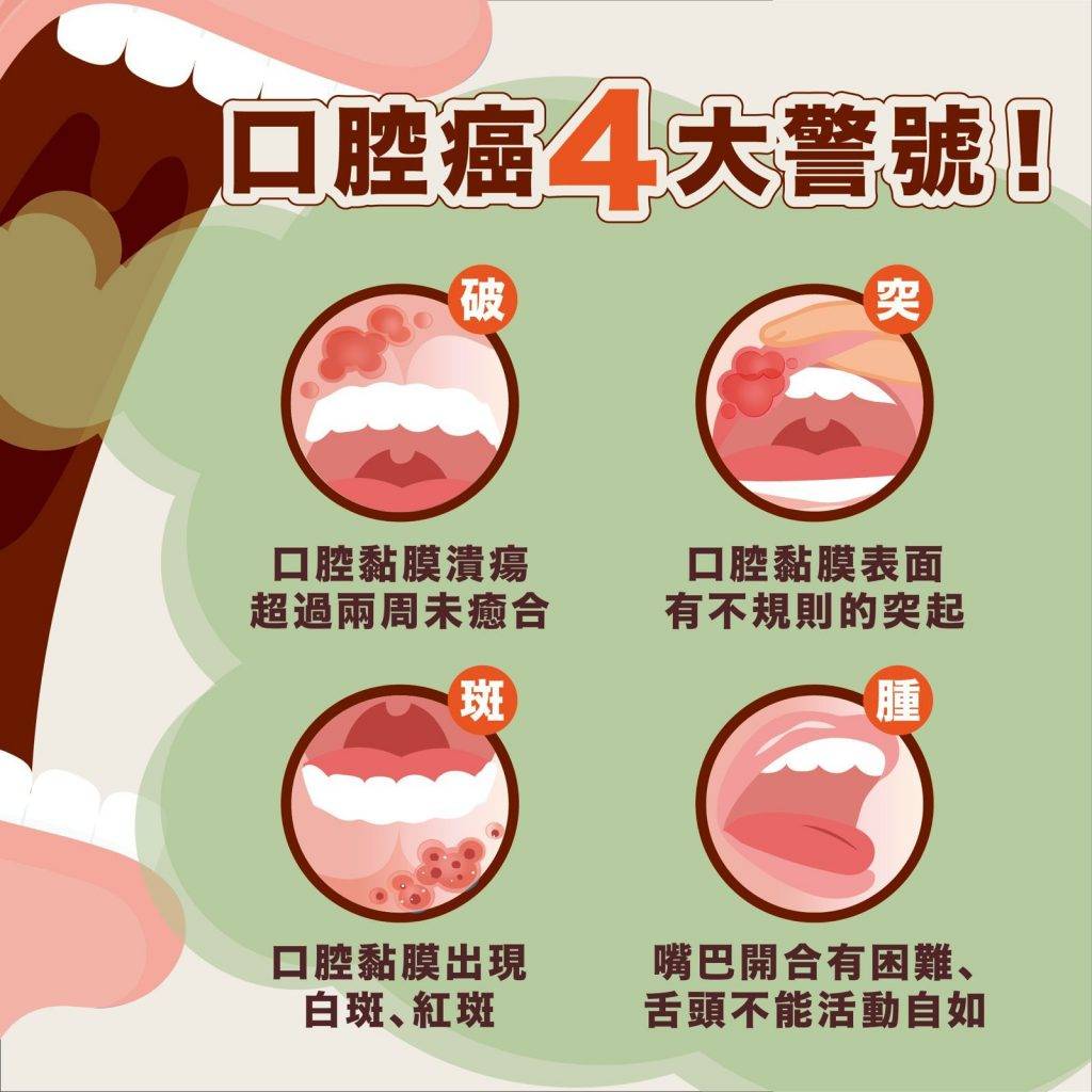 舌癌 口腔癌 (圖片來源:受訪者提供)