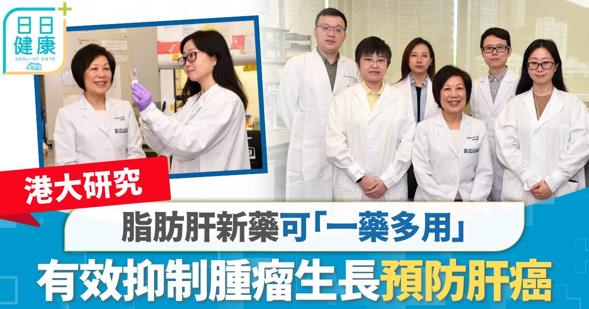 港大研究｜脂肪肝新藥可「一藥多用」　有效抑制腫瘤生長預防肝癌