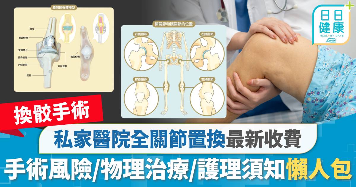 換骹手術費用2026｜私家醫院全關節置換收費 膝痛手術風險、物理治療與護理須知懶人包