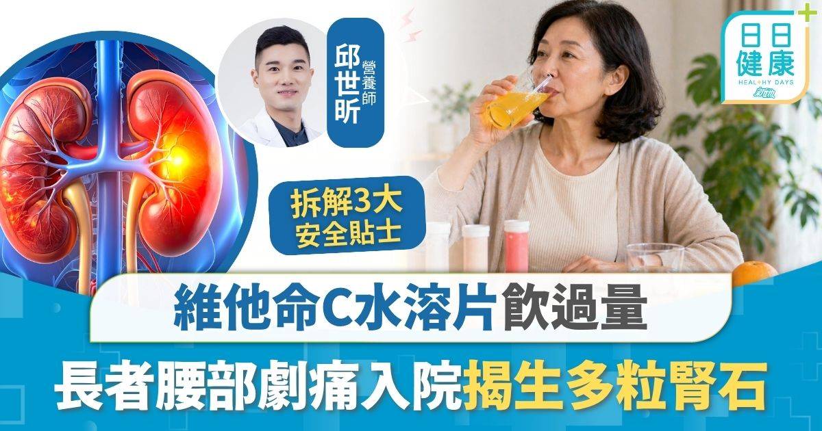 營養補充｜維他命C水溶片飲過量 長者生多粒腎石無法站立 拆解風險：血壓失控增心血管負擔
