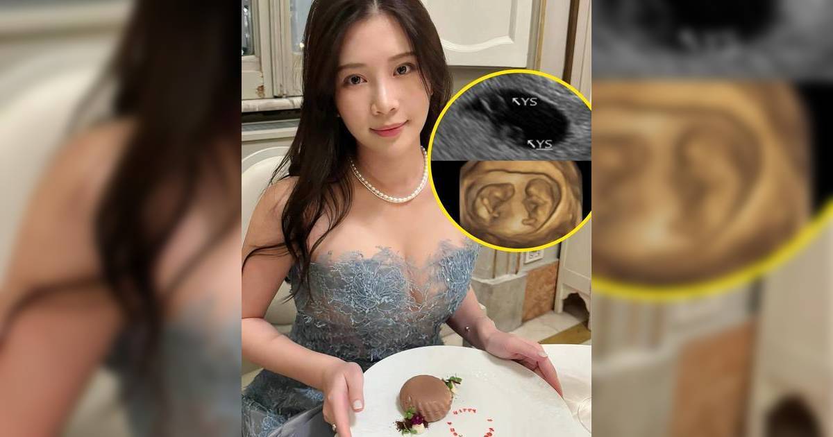 32歲雞排妹突宣布懷雙胞胎 6週聽見心跳瞬間落淚 背後原因超心酸