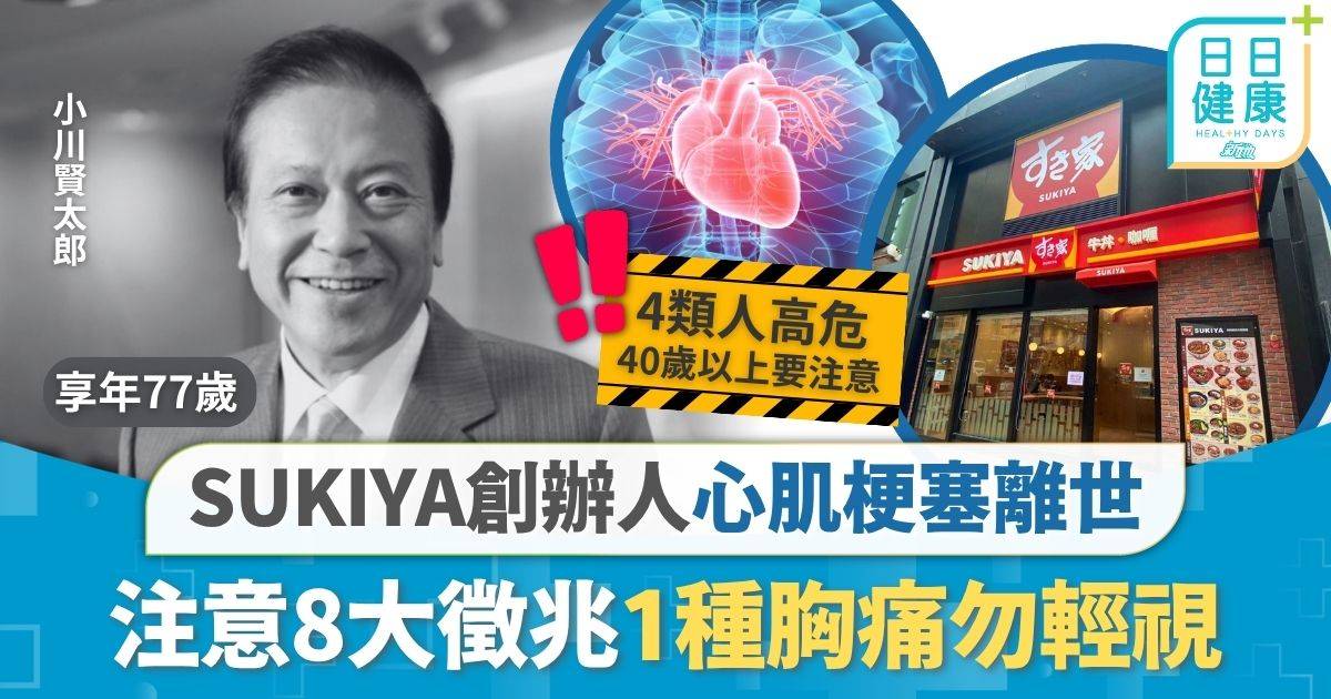 心肌梗塞｜曾任吉野家自立打造餐飲王國 牛丼SUKIYA創辦人心肌梗塞離世 注意8大徵兆1種胸痛勿輕視