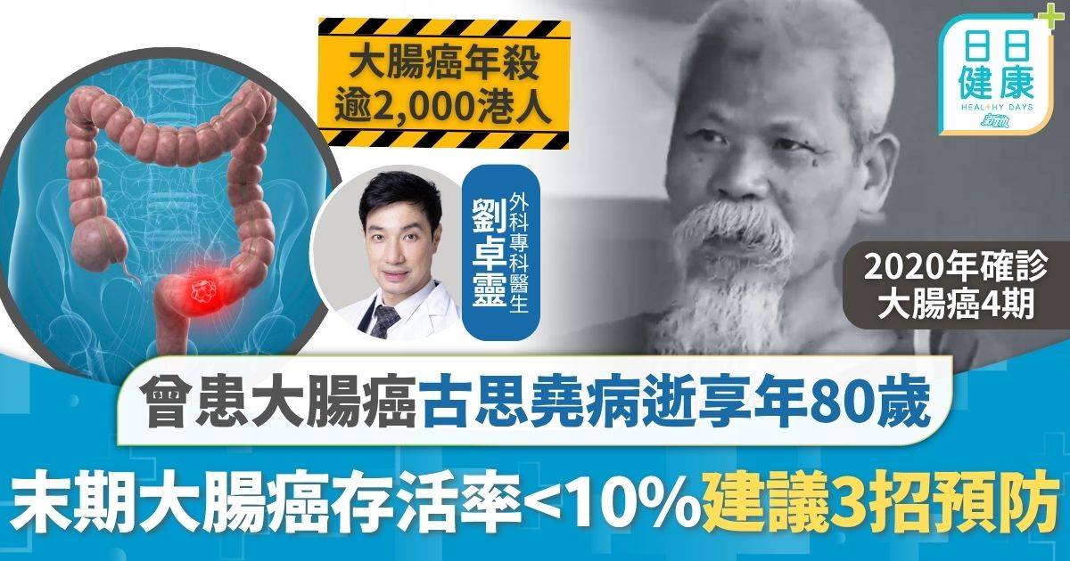 古思堯病逝｜曾患大腸癌古思堯病逝享年80歲 早期篩查大腸癌風險降9成 有年輕化趨勢醫生建議3招預防