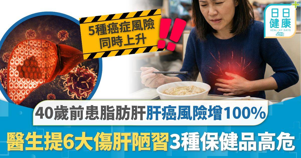 肝臟健康｜40歲前患脂肪肝 患肝癌風險激增100% 醫生提6大傷肝陋習3種保健品高危