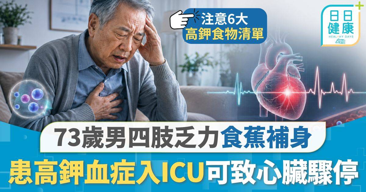 高鉀血症｜四肢乏力食蕉補身 73歲男患高鉀血症入ICU 醫生：嚴重可致心臟驟停