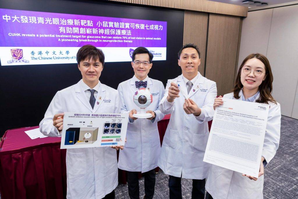 中大研究 青光眼 (左起)中大醫學院眼科及視覺科學學系副教授(臨床)陳培文醫生;何善衡眼科及視覺科學講座教授兼眼科及視覺科學學系系主任譚智勇教授;副教授朱偉傑博士及博士畢業生童妍博士。(圖片來源:中大醫學院)