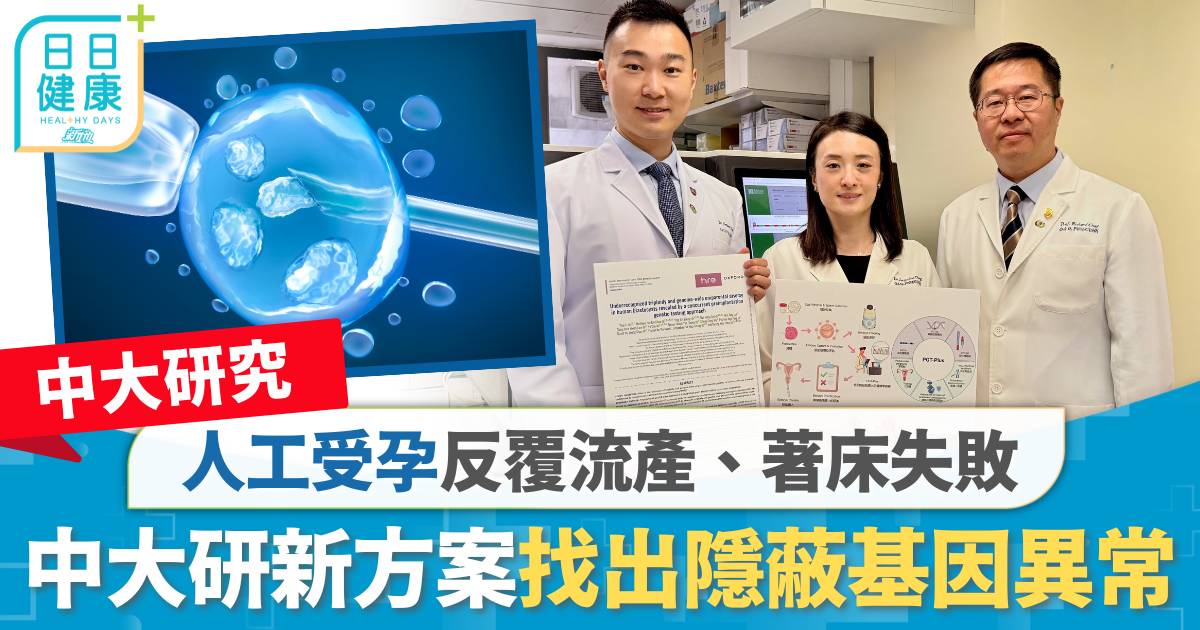 人工受孕反覆流產、著床失敗 中大研新方案找出隱蔽基因異常