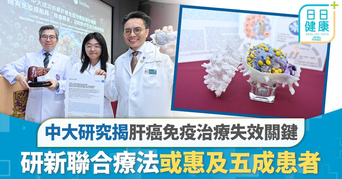 中大研究揭肝癌免疫治療失效關鍵 研新聯合療法或惠及五成患者