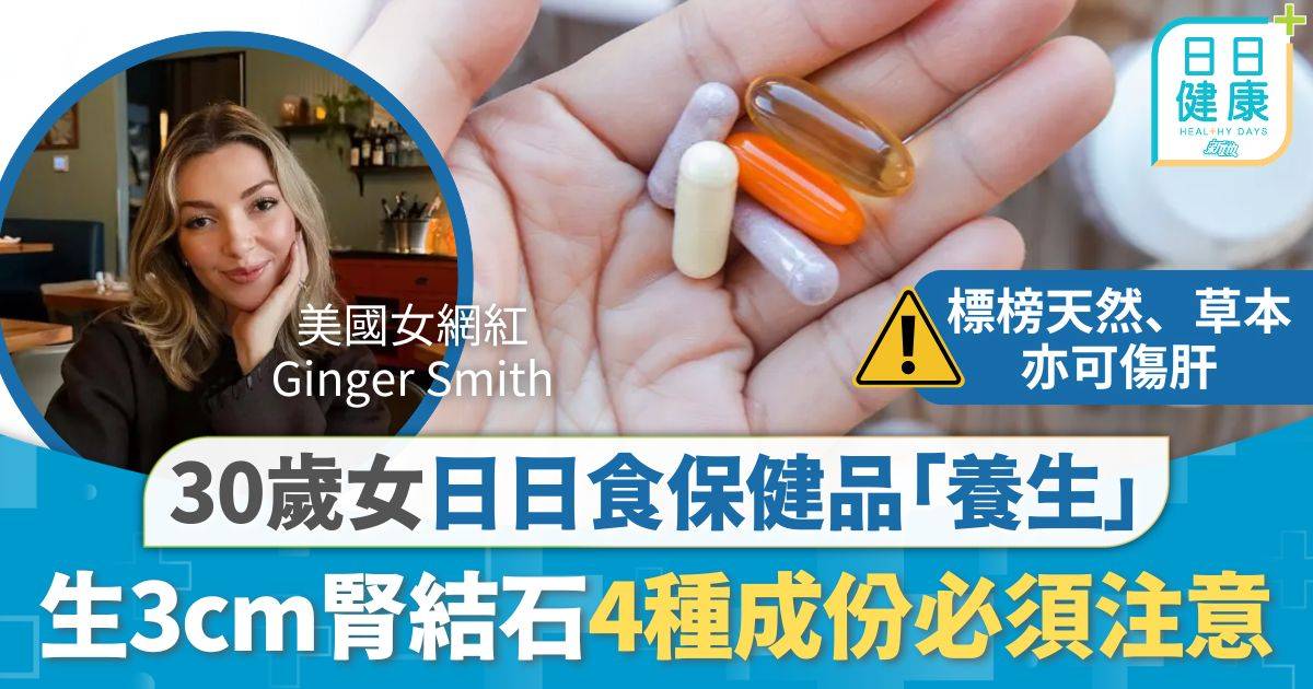 保健品｜30歲女日日食保健品「養生」 劇烈背痛驚見3cm腎結石 專家警告4種成份必須注意