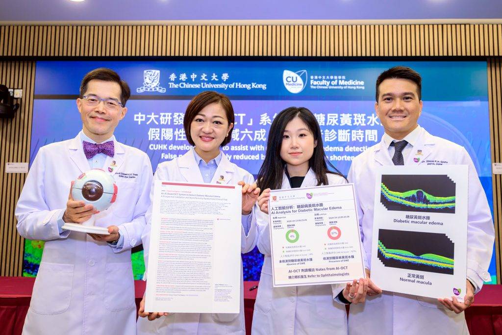 中大研究 糖尿上眼 (左起)何善衡眼科及視覺科學講座教授、中大醫學院眼科及視覺科學學系系主任譚智勇教授;中大醫學院眼科及視覺科學學系教授張艷蕾教授;中大醫學院眼科及視覺科學學系博士後研究員張樹意博士;及中大醫學院眼科及視覺科學學系臨床助理教授司徒家浩醫生。(圖片來源:中大醫學院)