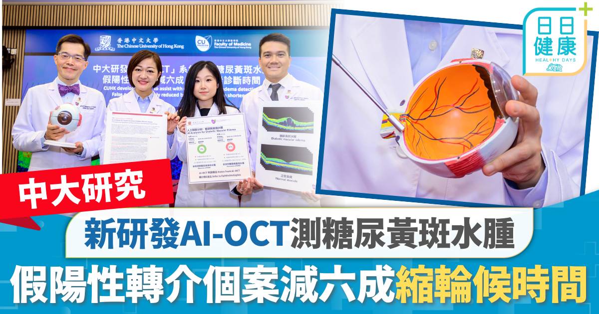 中大研究｜新研發AI-OCT測糖尿黃斑水腫 假陽性轉介個案減六成縮輪候時間