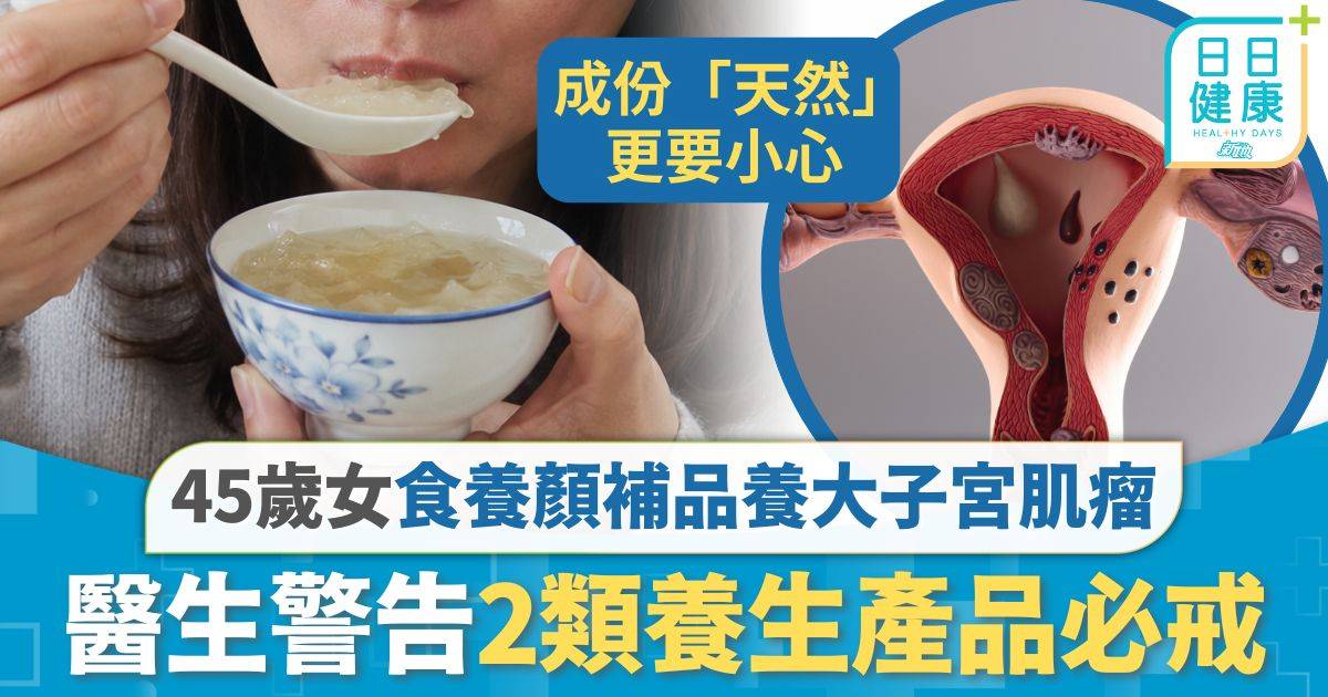 子宮肌瘤｜45歲女食養顏補品5年 子宮肌瘤「養大」變8cm 醫生警告2類養生產品必戒