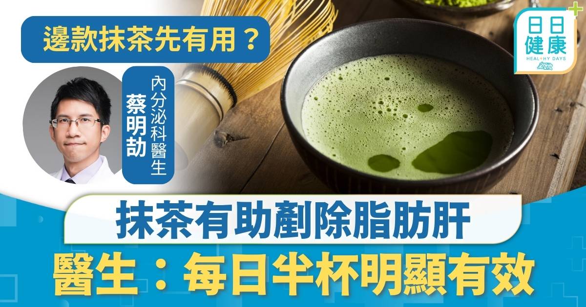 脂肪肝｜推算100萬港人患脂肪肝 抹茶有助剷除脂肪肝 醫生：每日半杯明顯有效