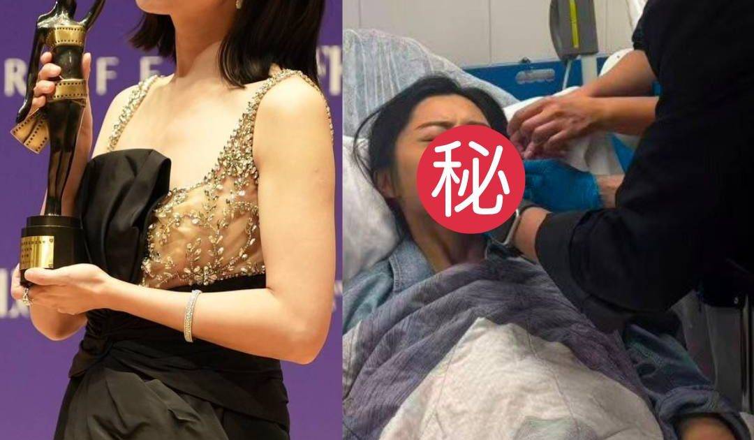 衛詩雅拍曾志偉新劇突傳重傷 口部縫逾50針宣布全面停工 老公急召整形外科醫生