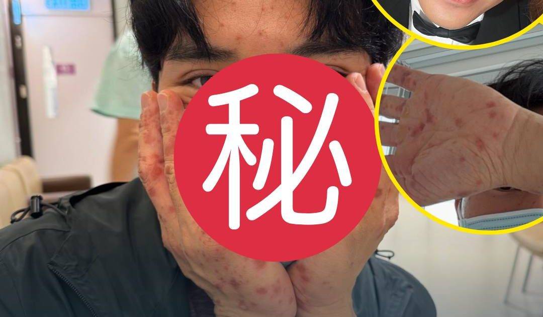 愛回家之開心速遞｜陳浚霆外遊遇恐佈感染毀容 預告或缺席結局聚會