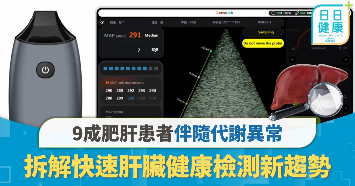 9成肥肝患者伴隨代謝異常 拆解快速肝脂檢測新趨勢