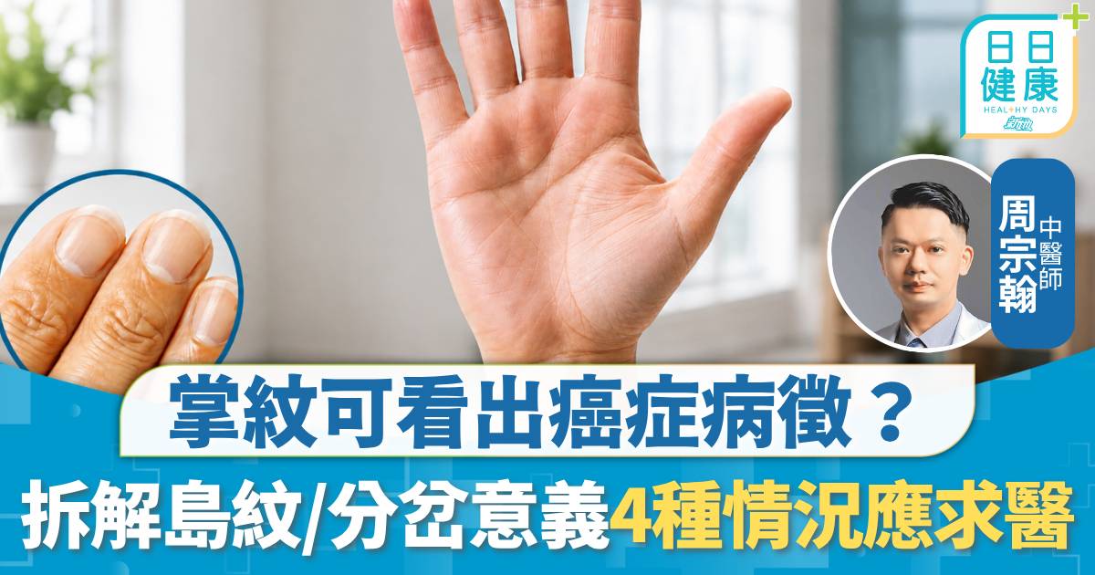 癌症病徵｜掌紋可看出癌症病徵？拆解島紋/分岔象徵意義 中醫：4種情況才是重點