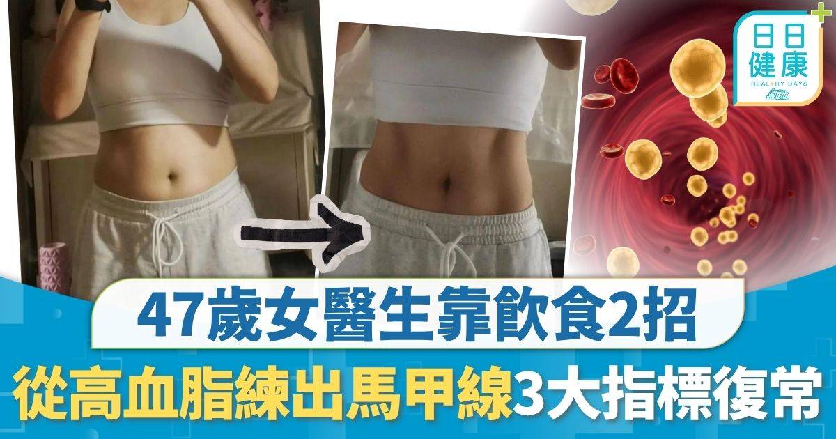 高血脂｜47歲女醫靠飲食2招 從高血脂練出馬甲線 毋須捱餓3大指標回復正常