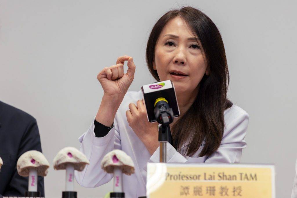 中大研究 類風濕關節炎 中大醫學院內科及藥物治療學系講座教授及風濕科主管譚麗珊教授指出,類風濕關節炎患者若能在黃金期內接受治療,可有效保護關節及減少長遠不可逆轉的損害。(圖片來源:中大醫學院提供)